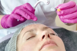 mezoterapia_iglowa_twarzy 